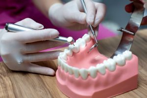 Can Dental Implants Cause Cancer?